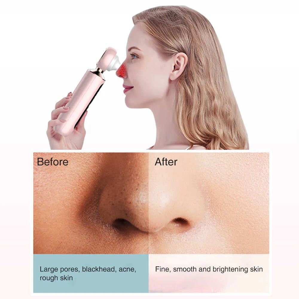 Auraé™ Blackhead Suction Machine