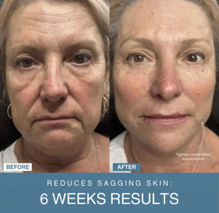 Auraé™ 7-in-1 LED Anti-Aging/Wrinkle Apparatus