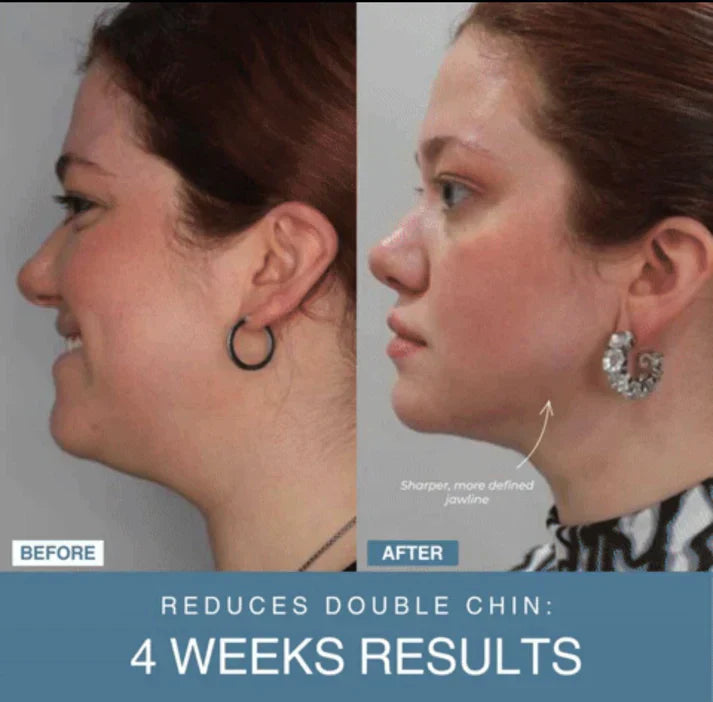 Auraé™ 7-in-1 LED Anti-Aging/Wrinkle Apparatus