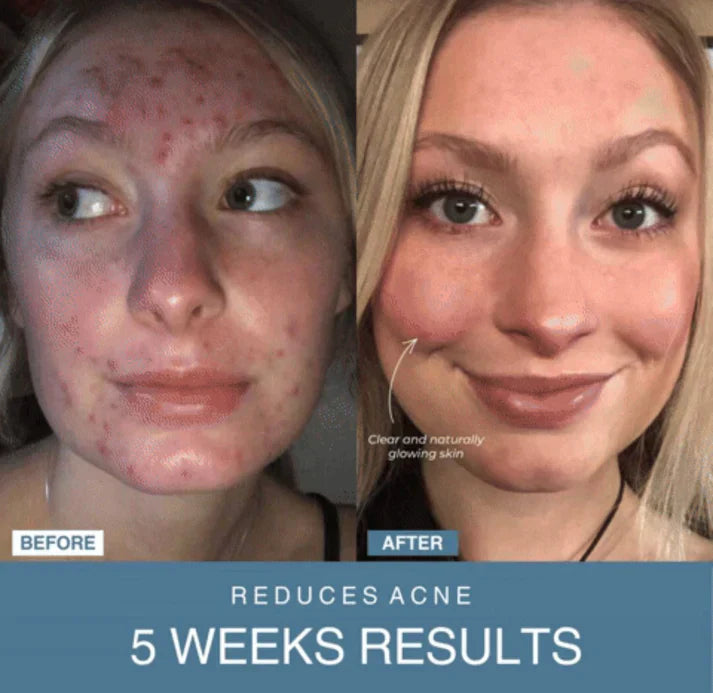 Auraé™ 7-in-1 LED Anti-Aging/Wrinkle Apparatus