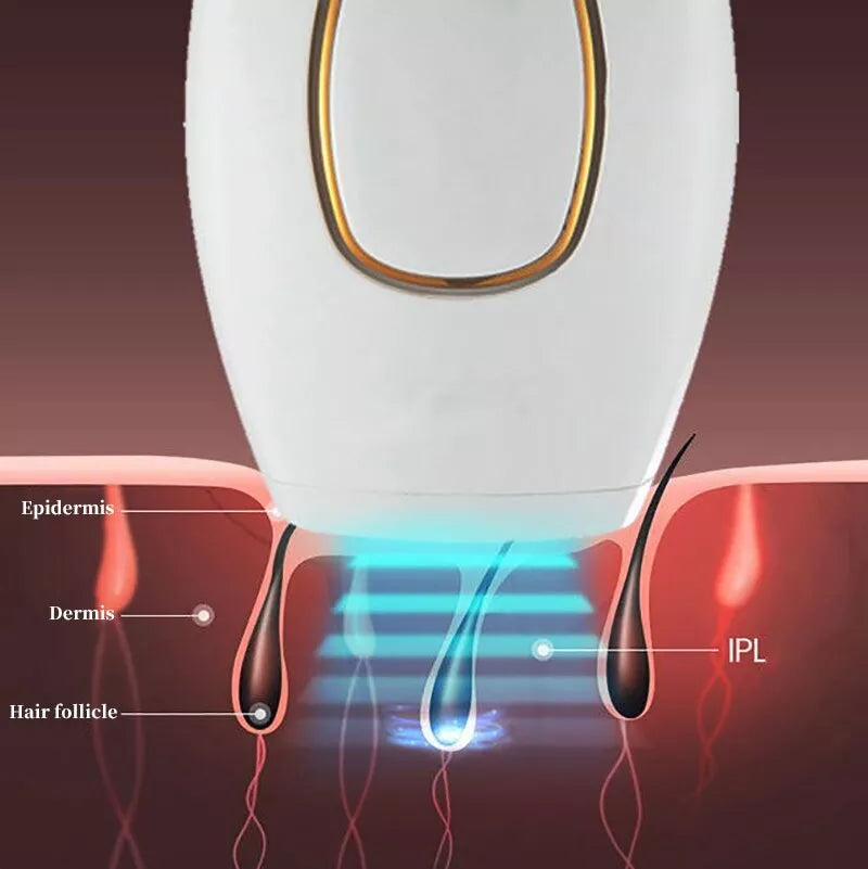 Auraé™ IPL Laser Hair Removal – جهاز إزالة الشعر بالليزر IPL